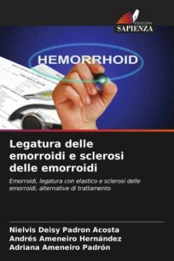 Legatura delle emorroidi e sclerosi delle emorroidi