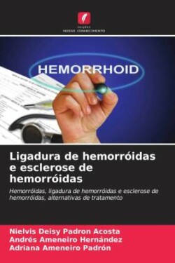 Ligadura de hemorróidas e esclerose de hemorróidas