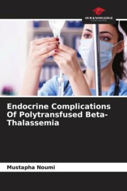 Endocrine Complications Of Polytransfused Beta- Thalassemia