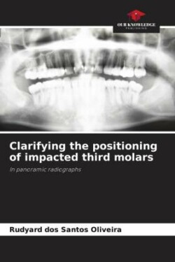 Clarifying the positioning of impacted third molars