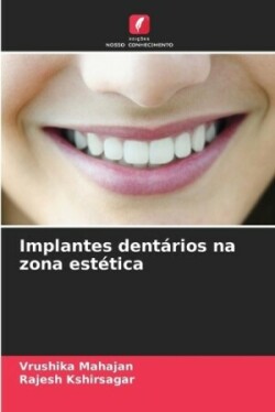 Implantes dent�rios na zona est�tica