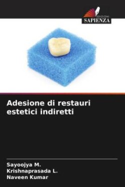 Adesione di restauri estetici indiretti
