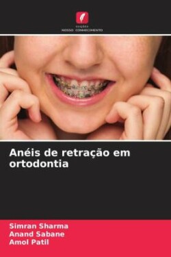 Anéis de retração em ortodontia