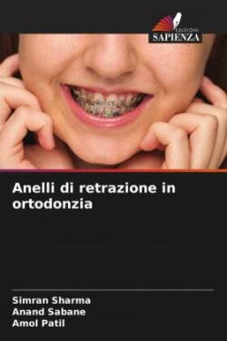 Anelli di retrazione in ortodonzia