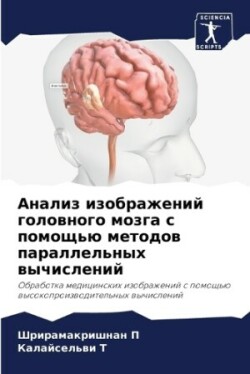 Анализ изображений головного мозга с пом&#1086
