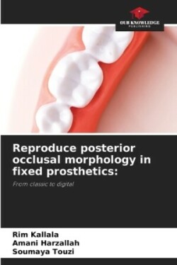 Reproduce posterior occlusal morphology in fixed prosthetics