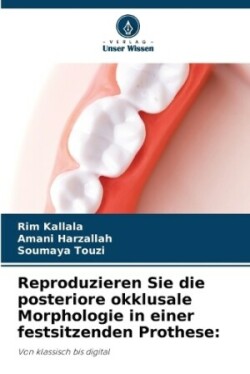 Reproduzieren Sie die posteriore okklusale Morphologie in einer festsitzenden Prothese