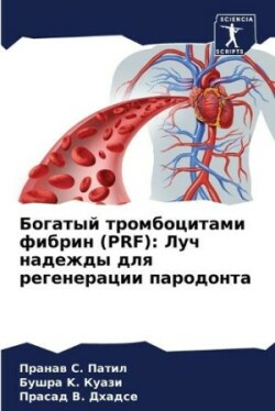 Богатый тромбоцитами фибрин (Prf)
