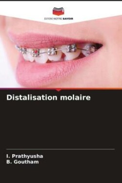 Distalisation molaire