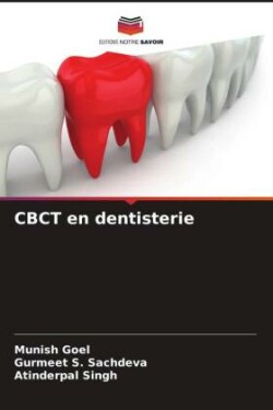 CBCT en dentisterie
