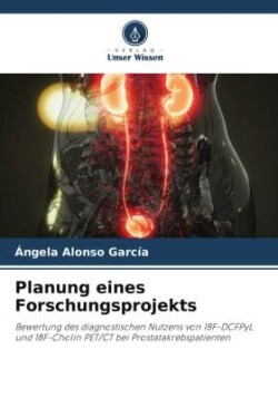 Planung eines Forschungsprojekts