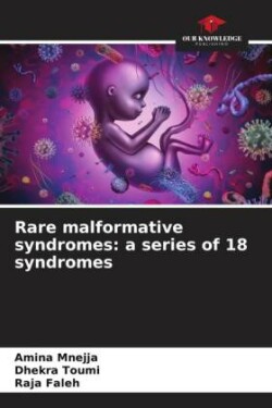 Rare malformative syndromes