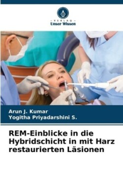 REM-Einblicke in die Hybridschicht in mit Harz restaurierten L�sionen