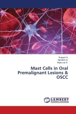 Mast Cells in Oral Premalignant Lesions & OSCC