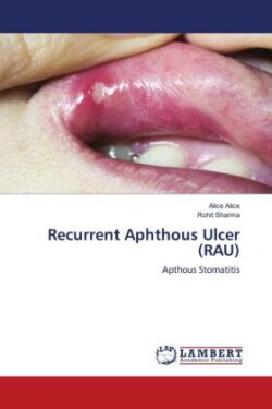 Recurrent Aphthous Ulcer (RAU)