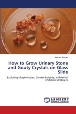 How to Grow Urinary Stone and Gouty Crystals on Glass Slide