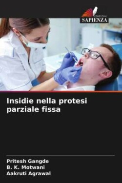 Insidie nella protesi parziale fissa