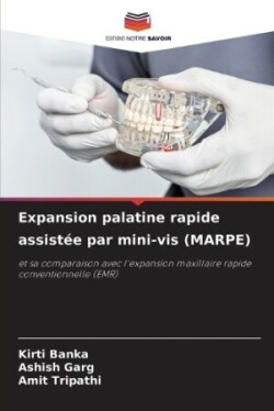 Expansion palatine rapide assistée par mini-vis (MARPE)