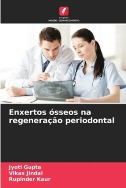 Enxertos ósseos na regeneração periodontal