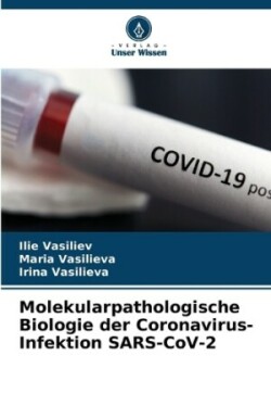 Molekularpathologische Biologie der Coronavirus-Infektion SARS-CoV-2