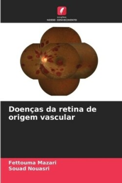 Doen�as da retina de origem vascular