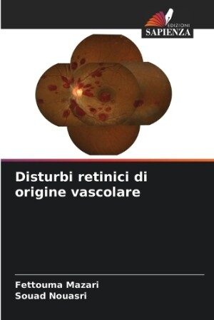Disturbi retinici di origine vascolare