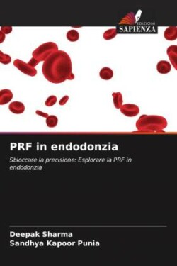 PRF in endodonzia