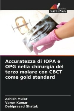 Accuratezza di IOPA e OPG nella chirurgia del terzo molare con CBCT come gold standard