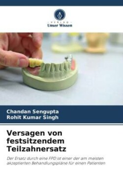 Versagen von festsitzendem Teilzahnersatz