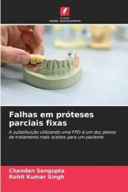 Falhas em pr�teses parciais fixas