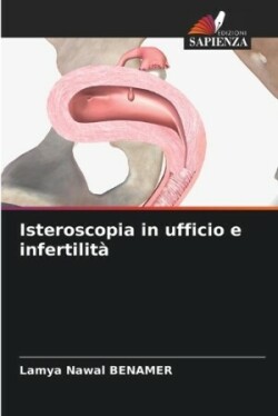 Isteroscopia in ufficio e infertilità