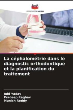 céphalométrie dans le diagnostic orthodontique et la planification du traitement