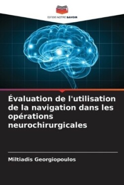 Évaluation de l'utilisation de la navigation dans les opérations neurochirurgicales