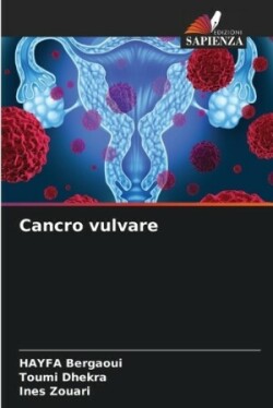 Cancro vulvare