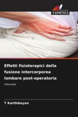 Effetti fisioterapici della fusione intercorporea lombare post-operatoria