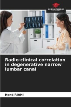 Radio-clinical correlation in degenerative narrow lumbar canal