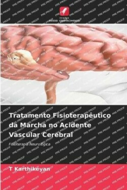 Tratamento Fisioterapêutico da Marcha no Acidente Vascular Cerebral