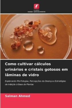 Como cultivar cálculos urinários e cristais gotosos em lâminas de vidro