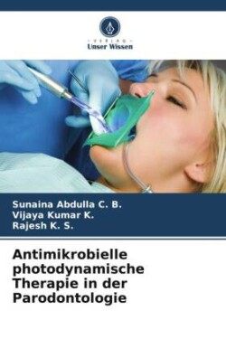 Antimikrobielle photodynamische Therapie in der Parodontologie