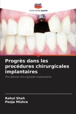 Progrès dans les procédures chirurgicales implantaires