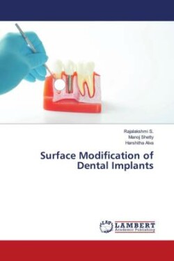 Surface Modification of Dental Implants