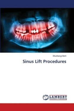 Sinus Lift Procedures