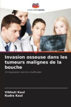 Invasion osseuse dans les tumeurs malignes de la bouche