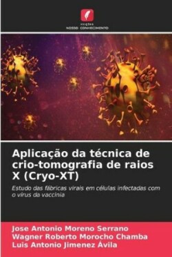 Aplicação da técnica de crio-tomografia de raios X (Cryo-XT)