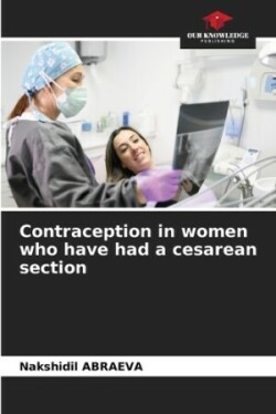 Contraception in women who have had a cesarean section