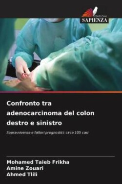 Confronto tra adenocarcinoma del colon destro e sinistro