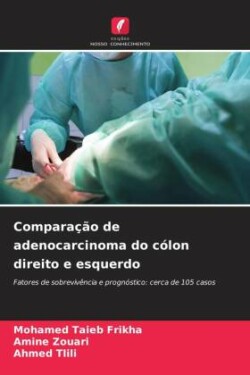 Comparação de adenocarcinoma do cólon direito e esquerdo