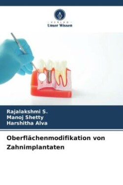 Oberflächenmodifikation von Zahnimplantaten