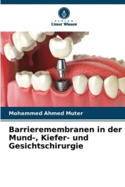 Barrieremembranen in der Mund-, Kiefer- und Gesichtschirurgie