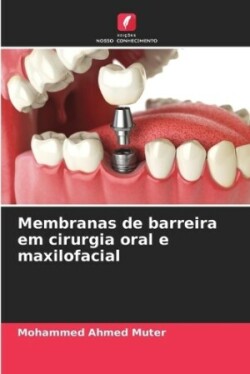 Membranas de barreira em cirurgia oral e maxilofacial